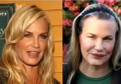 A picture of Daryl Hannah before (left) and after (right).